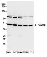 HADHB Antibody in Western Blot (WB)