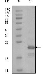 HAND1 Monoclonal Antibody (8E7A11,8C2F4)