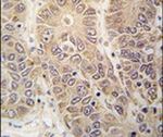 HARS Antibody in Immunohistochemistry (IHC)
