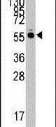HARS Antibody in Western Blot (WB)