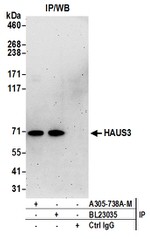 HAUS3 Polyclonal Antibody