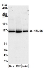 HAUS6 Antibody in Western Blot (WB)