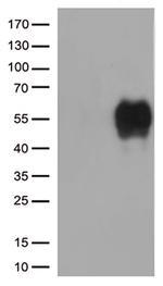 HAVCR2 Antibody in Western Blot (WB)