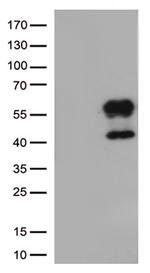 HAVCR2 Antibody in Western Blot (WB)