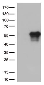 HAVCR2 Antibody in Western Blot (WB)
