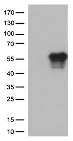 HAVCR2 Antibody in Western Blot (WB)