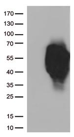 HAVCR2 Antibody in Western Blot (WB)