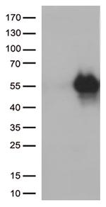 HAVCR2 Antibody in Western Blot (WB)