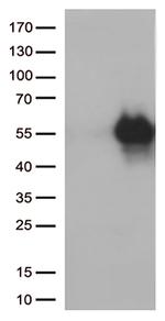 HAVCR2 Antibody in Western Blot (WB)