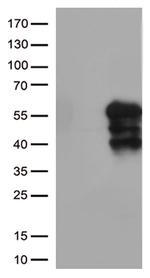 HAVCR2 Antibody in Western Blot (WB)