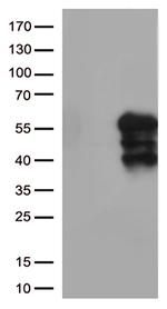 HAVCR2 Antibody in Western Blot (WB)