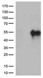 HAVCR2 Antibody in Western Blot (WB)