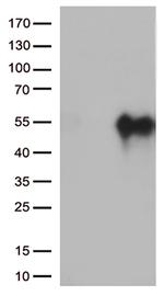 HAVCR2 Antibody in Western Blot (WB)