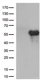 HAVCR2 Antibody in Western Blot (WB)