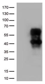 HAVCR2 Antibody in Western Blot (WB)