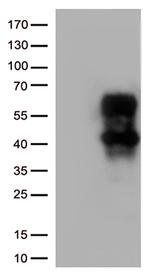 HAVCR2 Antibody in Western Blot (WB)