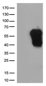 HAVCR2 Antibody in Western Blot (WB)