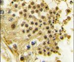 MYST2 Antibody in Immunohistochemistry (IHC)