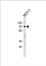 MYST2 Antibody in Western Blot (WB)