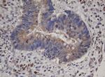 HBS1L Antibody in Immunohistochemistry (Paraffin) (IHC (P))