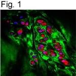 ITIH1 Antibody in Immunohistochemistry (Paraffin) (IHC (P))