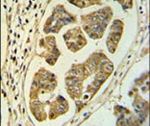 HCCS Antibody in Immunohistochemistry (IHC)