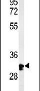 HCCS Antibody in Western Blot (WB)
