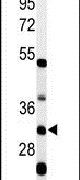HCCS Antibody in Western Blot (WB)