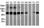 HDAC1 Antibody in Western Blot (WB)