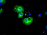 HDAC10 Antibody in Immunocytochemistry (ICC/IF)