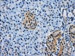 HDAC10 Antibody in Immunohistochemistry (Paraffin) (IHC (P))