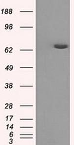 HDAC10 Antibody in Western Blot (WB)