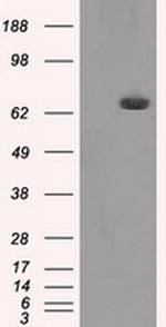 HDAC10 Antibody in Western Blot (WB)