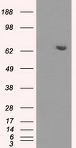 HDAC10 Antibody in Western Blot (WB)