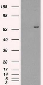 HDAC10 Antibody in Western Blot (WB)