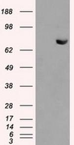 HDAC10 Antibody in Western Blot (WB)