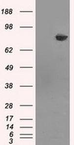 HDAC10 Antibody in Western Blot (WB)