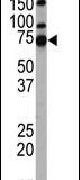HDAC10 Antibody in Western Blot (WB)