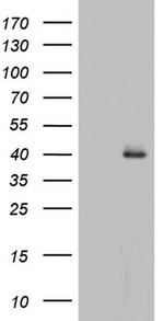 HDAC11 Antibody in Western Blot (WB)