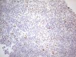 HDAC2 Antibody in Immunohistochemistry (Paraffin) (IHC (P))
