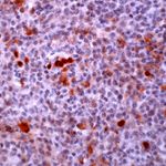 HDAC2 Antibody in Immunohistochemistry (IHC)