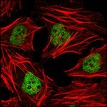 HDAC3 Antibody in Immunocytochemistry (ICC/IF)