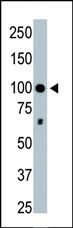HDAC4 Antibody in Western Blot (WB)