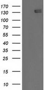 HDAC6 Antibody in Western Blot (WB)