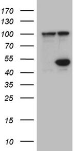 HDAC8 Antibody in Western Blot (WB)