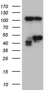 HDAC8 Antibody in Western Blot (WB)