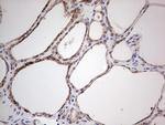HDAC9 Antibody in Immunohistochemistry (Paraffin) (IHC (P))