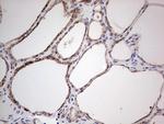 HDAC9 Antibody in Immunohistochemistry (Paraffin) (IHC (P))