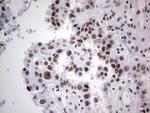 HDAC9 Antibody in Immunohistochemistry (Paraffin) (IHC (P))