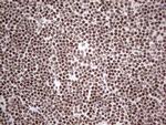 HDAC9 Antibody in Immunohistochemistry (Paraffin) (IHC (P))